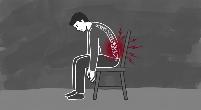 5 Primary Signs of a Bulging Disc in Your Lower Back (And Why They Recur)