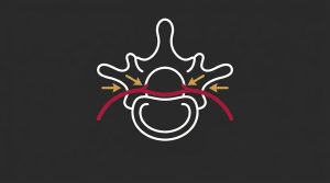 How Long Does Nerve Restoration Take to Show Clinical Results?