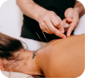 acupuncture treatment as part of neuropathy care at touch of wellness chiropractic