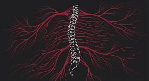 Functional Recovery vs. Standard Physical Therapy for Chronic Pain