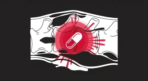 Animal Chiropractic vs. NSAIDs for Horses: Restorative Care vs. Symptom Masking