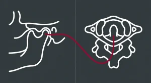 Why Your Jaw Pain Might Actually Be an Upper Cervical Spine Alignment Issue